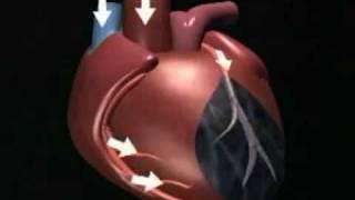 EECP India EECP Treatment EECP Therapy mechanism.mp4