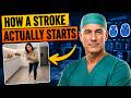 Signs a Stroke Is Coming — Most Americans Miss All of Them