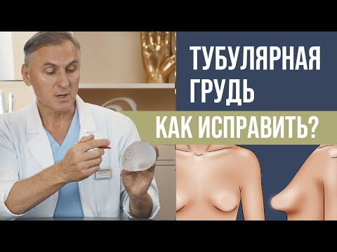 ТУБУЛЯРНАЯ ГРУДЬ 🧐 КАК ИСПРАВИТЬ ФОРМУ?