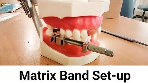 Matrix Band set up || Tofflemire Set up
