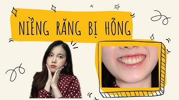 Hành trình niềng răng 5 năm | Niềng răng hỏng sẽ như thế nào?