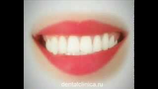 Лечение зубов имплантация в Москве Санкт-Петербурге European Clinic of Aesthetic Dentistry(Клиника премиум-класса European Clinic of Aesthetic Dentistry http://dentalclinica.ru Стоматологическое лечение у нас обойдется Вам..., 2014-03-30T10:29:39.000Z)