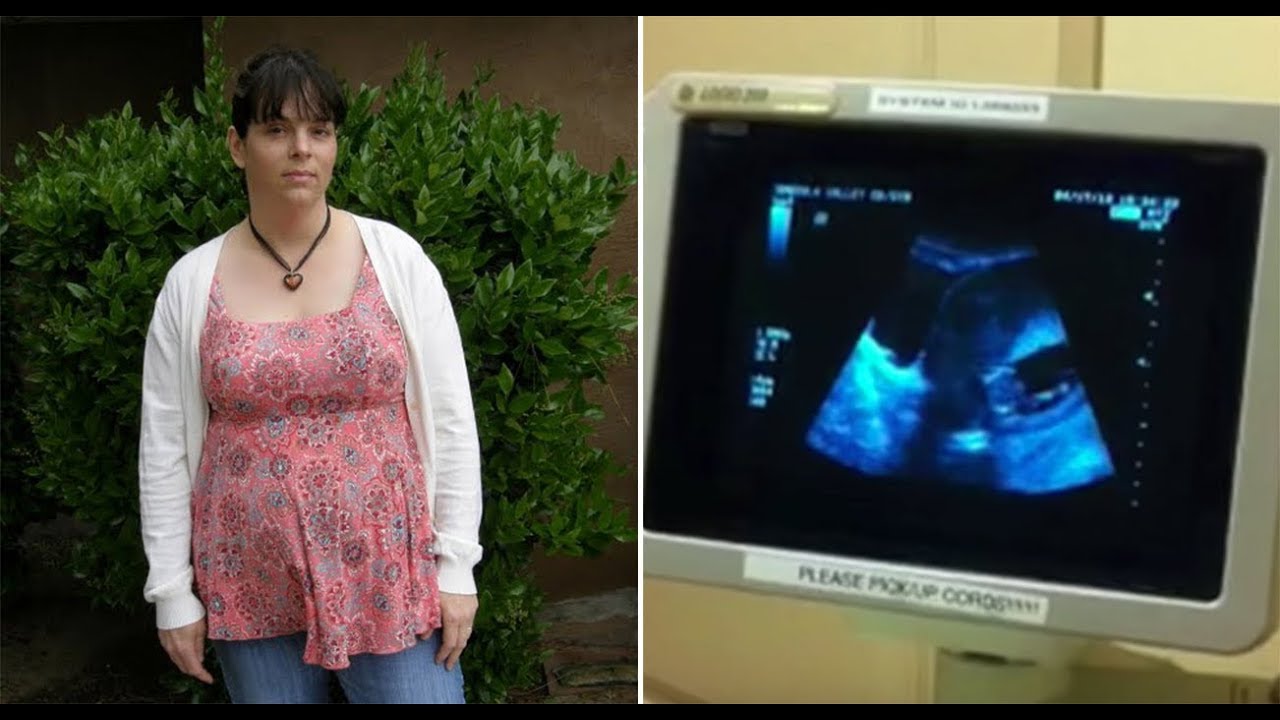 This Mom-Of-18 Was Struggling For Another Child, So Doctors Were Stunned When They Saw Her Scan This Mom-Of-18 Was Struggling For Another Child, So Doctors Were Stunned When They Saw Her Scan