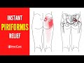 How to get rid of piriformis pain for good