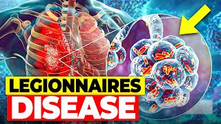 Legionnaires Disease The Hidden Urban Danger