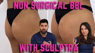Celebrity Non Surgical BBL with Sculptra | Natural Brazilian Butt Lift | Volume | Hips Dips | Cellulite Profile