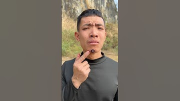 🌺🍒How I Cured a Bug Bite with Yogurt in Wild Survival Hacks🌸🍒 #funny #shorts😜🥰🌺🌸🍒