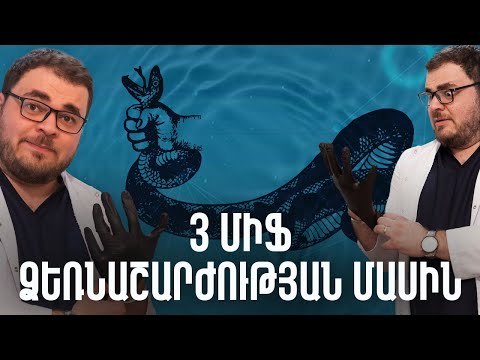 Video: Երբ զամբյուղով մարզվում եք, ի՞նչ անել գիշերը: