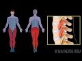 Nerve Root Block Injection Procedure Animation Video 
