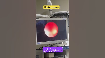Thumbnail of #music #cover #song #singer #coversong #youtubeshorts #doctor #urology #ureteralstone #urologist