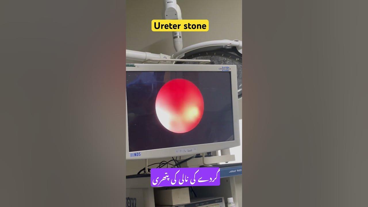 #music #cover #song #singer #coversong #youtubeshorts #doctor #urology #ureteralstone #urologist