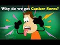 Why do we get Canker Sores (ulcers)? + more videos | #aumsum #kids #science #education #children