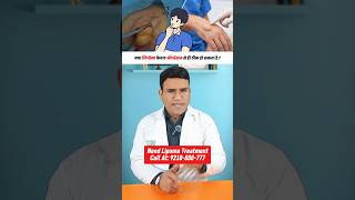 क्या बिना Operation के Lipoma ठीक हो सकता है ? | Dr Tomars