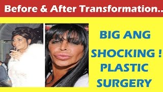 Big Ang Plastic Surgery Before and After Full HD