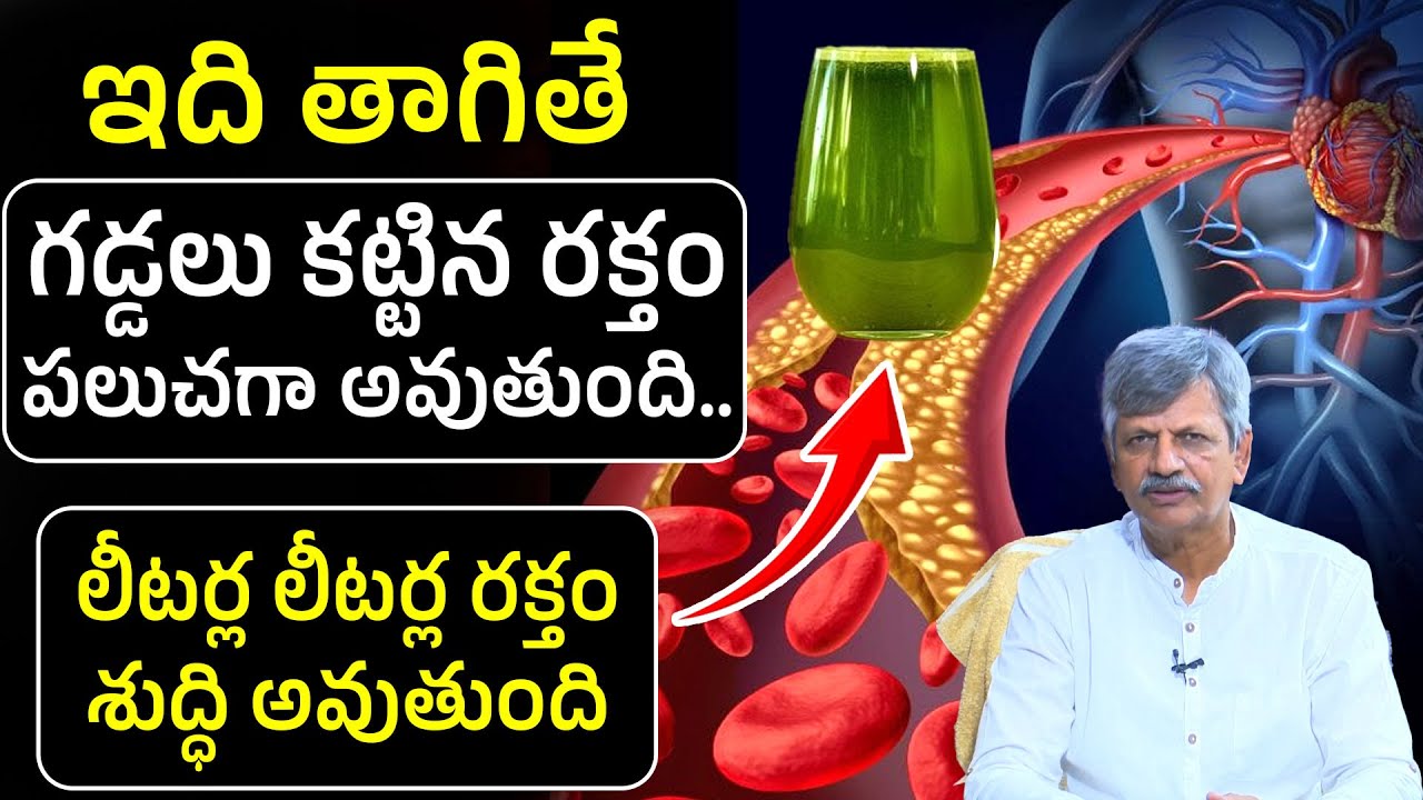 ఇది తాగితే  గడ్డలు కట్టిన రక్తం కూడా పలుచగా అవుతుంది..| Blood Purification Technique | I Dream