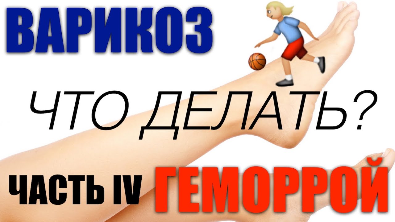 Варикозное расширение вен: часть четвертая. - YouTube