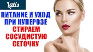 ПИТАНИЕ И УХОД ПРИ КУПЕРОЗЕ - СТИРАЕМ СОСУДИСТУЮ СЕТОЧКУ ПИТАНИЕ И УХОД ПРИ КУПЕРОЗЕ - СТИРАЕМ СОСУДИСТУЮ СЕТОЧКУ
