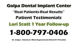 Lori 1 Year Follow-up | Golpa G4-Implant Solution Patient Testimonial