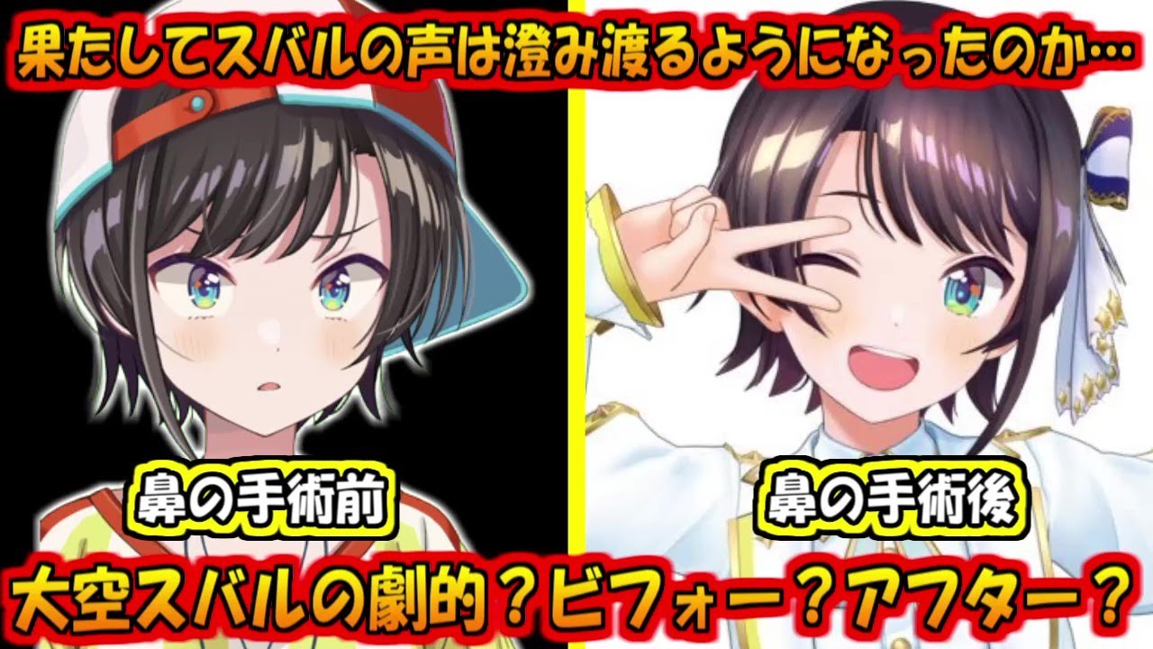 大空スバルの鼻。劇的？ビフォーアフター？