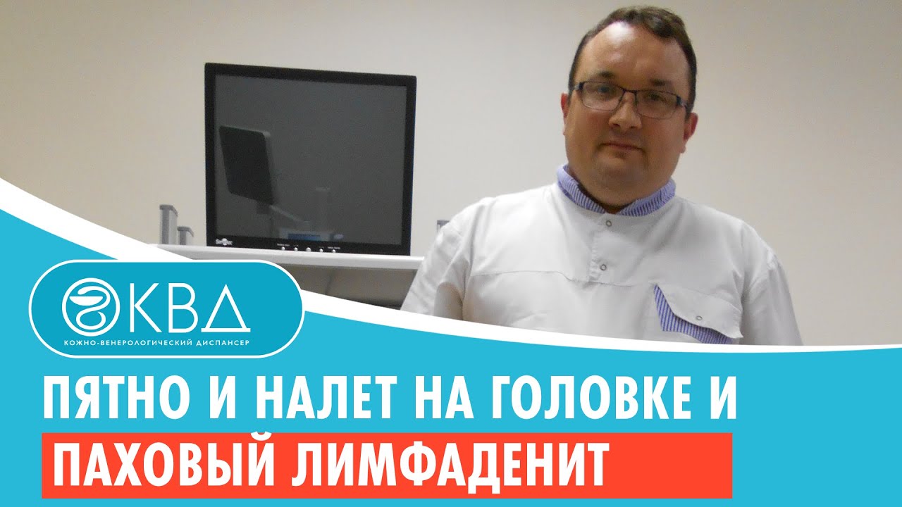 ↪ Пятно и налет на головке и паховый лимфаденит. Клинический случай №1004
