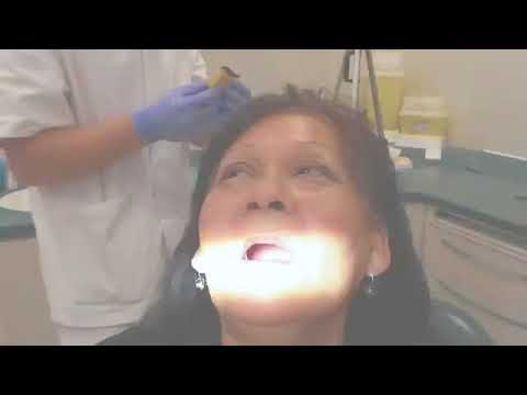 Vidéo: Pâte Adhésive Dentaire Solcoseryl - Mode D'emploi, Prix
