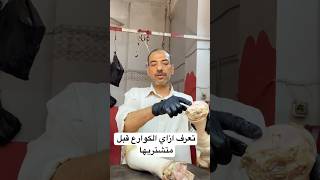 تعرف ازاي الكوارع قبل متشتريها??.        خالد_الجزار