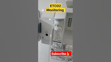 ETCO2 MONITORING | NORMAL RANGE 35 to 45mmhg  | VENTILATION #shorts #vtshorts