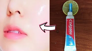 Toothpaste & Lemon, Easy way to get white skin | Get flawless, clear skin.#1 | Facial Skin