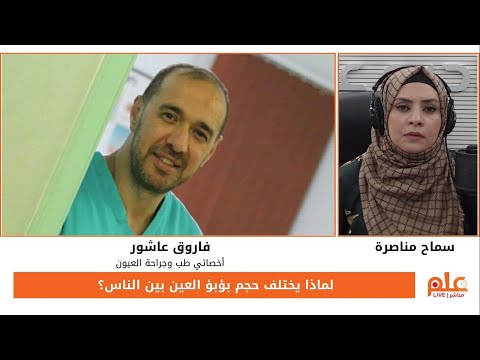 توسع بؤبؤ واحد إما ظاهرة خلقية أو مرضية كيف نمي ز بينهما