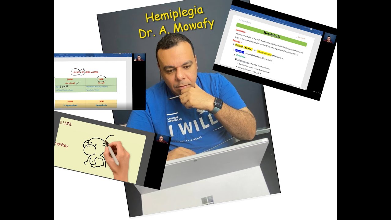 Hemiplegia 1  Neurology Dr. A. Mowafy Online lecture شرح نيورولوجي  د. احمد موافي