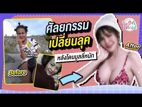 คนเคยศัลย์ I โดนบูลลี่หนัก ถูกด่าว่าขี้เหร่ !! เปลี่ยนหน้าจนสวย แค่ทำ...