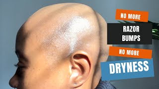 HEALTHY SCALP ROUTINE FOR BALD WOMEN 👋🏾say goodbye 2 RAZOR BUMPS, DRYNESS & DISCOLORATION by Gabrielle Hamilton 3,306 views 1 year ago 8 minutes, 38 seconds