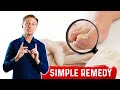 Use Epsom Salt For Toenail Fungus - Treatment For Toenail Fungus | Dr.Berg