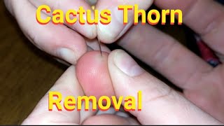 Removing 7 week old Cactus thorn