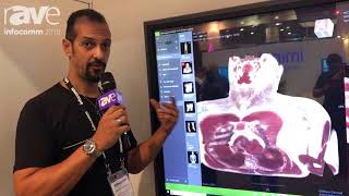 InfoComm 2018: Apek International Demos 3D Body Imaging Solution for Hospitals And Education screenshot 1