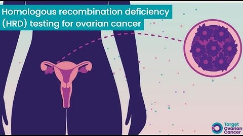 Homologous recombination deficiency HRD testing for ovarian cancer