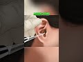 Relaxing Deep Ear Wax Removal ASMR Sounds RELAXING SOUND Shorts Relaxing Deep Ear Wax Removal ASMR Sounds RELAXING SOUND Shorts