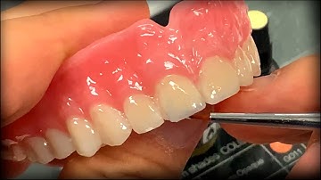 How to Make Digital Print Dentures Pretty