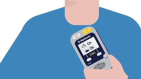 Medtronic DBS Patient Programmer–How to Use Animation