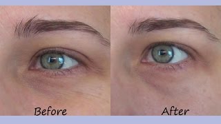 kiehls powerful strength eye serum