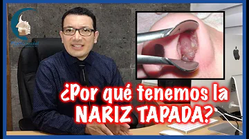 ¿Por qué siempre tengo la nariz tapada aunque no esté enfermo?