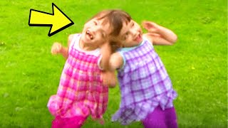 These Twins Share a Brain, They can See through each other's eyes! Watch HOW? by CreepyWorld 496 views 1 month ago 3 minutes, 39 seconds