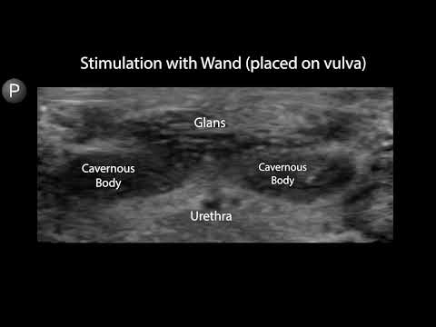 Sonography Of Clitoral Blood Flow