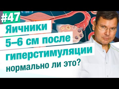 Яичники после гиперстимуляции 5 – 6 см. Небольшое вздутие живота. Это нормально?