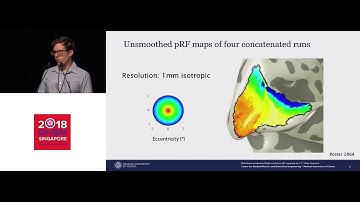 OHBM 2018 | Oral Session | Allan Hummer | Multi-band accelerated high resolution population recept…