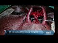 Jaipurdoorbeen hospital live stream