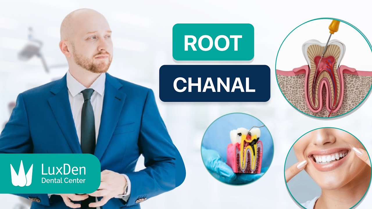 Pain-Free Root Canal Treatment You Can Trust – LuxDen Brooklyn