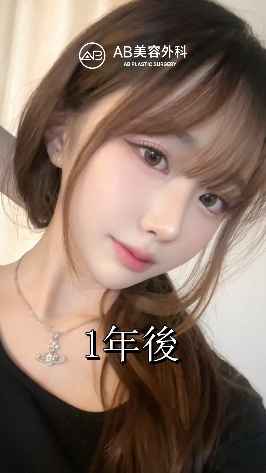 これが韓国整形の力！劇的すぎる変化 #shorts