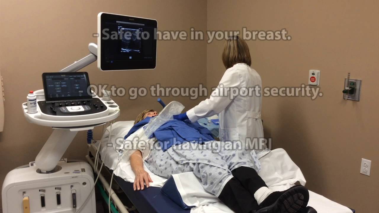 Ultrasound Guided Breast Biopsy Eskenazi Hospital English Version YouTube