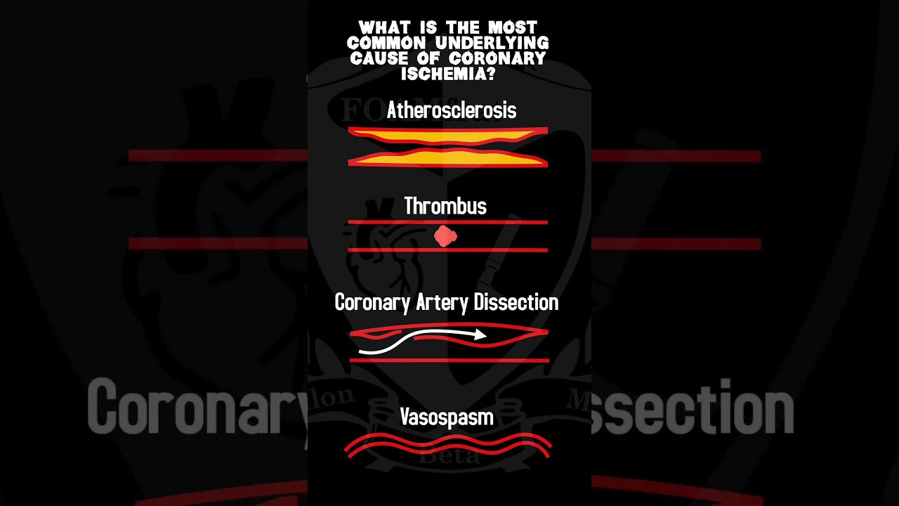 10 second quiz!